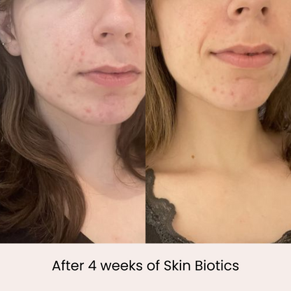 Skin Biotics